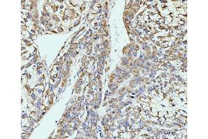IHC analysis of GIT1 using anti-GIT1 antibody (ABIN7601683). (GIT1 anticorps  (AA 415-736))