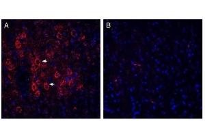 Expression of VGLUT2 in rat parietal cortex.