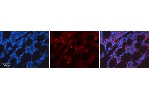 Rabbit Anti-CDK6 Antibody  AV Formalin Fixed Paraffin Embedded Tissue: Human Bone Marrow Tissue Observed Staining: Cytoplasm, Nucleus Primary Antibody Concentration: 1:100 Other Working Concentrations: N/A Secondary Antibody: Donkey anti-Rabbit-Cy3 Secondary Antibody Concentration: 1:200 Magnification: 20X Exposure Time: 0. (CDK6 anticorps  (C-Term))