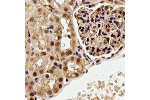 Immunohistochemical analysis of ALG-2 staining in rat kidney formalin fixed paraffin embedded tissue section.