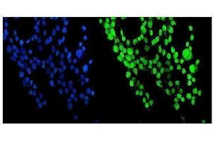 IF analysis of NUP214 using anti-NUP214 antibody (ABIN7601473).