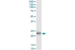 TPT1 monoclonal antibody (M03), clone 2C4.