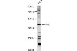 Western blot analysis of extracts of PC-3 cells, using HY antibody  at 1:500 dilution. (HYAL1 anticorps  (AA 136-435))