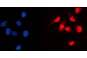 IF analysis of GCKR using anti-GCKR antibody (ABIN7602493).