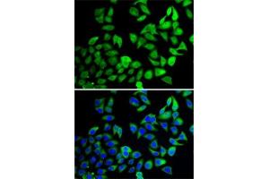 Immunofluorescence analysis of A-549 cells using USP8 antibody (ABIN6132776, ABIN6150035, ABIN6150036 and ABIN6222811). (USP8 anticorps  (AA 1-270))