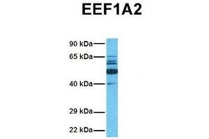 Host:  Rabbit  Target Name:  EEF1A2  Sample Tissue:  Human Jurkat  Antibody Dilution:  1.