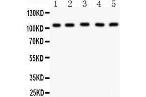 Anti- MSH2 Picoband antibody, Western blotting All lanes: Anti MSH2  at 0.