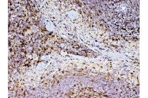 IHC analysis of ADA using anti-ADA antibody . (ADA anticorps  (AA 2-238))