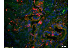 Formalin-fixed and paraffin embedded rat colon tissue labeled with Anti AT2R/AT1 Polyclonal Antibody, Unconjugated (ABIN668616) at 1:200 followed by secondary antibody was Goat Anti-Rabbit IgG, Cy3 conjugated  used at 1:200 dilution for 40 minutes at 37 °C.