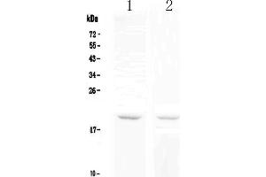 Western blot analysis of BCMA using anti-BCMA antibody .