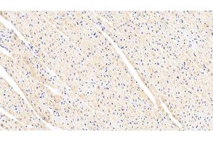 Detection of LEP in Human Cardiac Muscle Tissue using Polyclonal Antibody to Leptin (LEP)