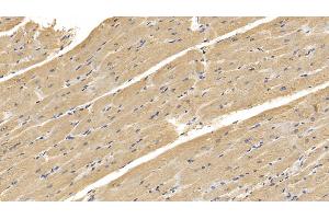 Detection of RNLS in Human Cardiac Muscle Tissue using Monoclonal Antibody to Renalase (RNLS)
