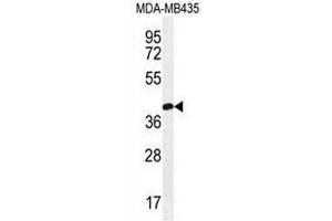 CLDN16 Antibody (N-term) western blot analysis in MDA-MB435 cell line lysates (35µg/lane). (Claudin 16 anticorps  (N-Term))