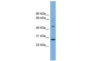 WB Suggested Anti-ZNF514 Antibody Titration:  0. (ZNF514 anticorps  (Middle Region))