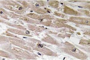 Immunohistochemistry analysisof BMP-2 Antibody in paraffin-embedded human heart tissue. (BMP2 anticorps)
