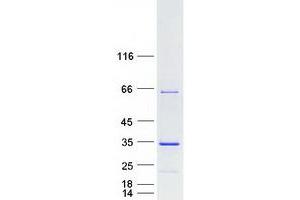 Validation with Western Blot
