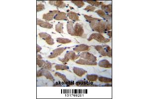 ACTN3 Antibody immunohistochemistry analysis in formalin fixed and paraffin embedded human skeletal muscle followed by peroxidase conjugation of the secondary antibody and DAB staining. (ACTN3 anticorps  (AA 409-437))