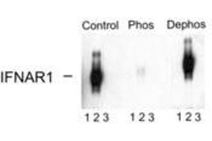 Image no. 1 for anti-Interferon alpha/beta Receptor 1 (IFNAR1) (pSer535), (Ser539) antibody (ABIN228236) (IFNAR1 anticorps  (pSer535, Ser539))