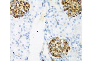 Immunohistochemistry of paraffin-embedded Rat kidney using CSRNP1 Polyclonal Antibody at dilution of 1:200 (40x lens). (AXUD1 anticorps)