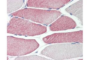 Human Skeletal Muscle: Formalin-Fixed, Paraffin-Embedded (FFPE)