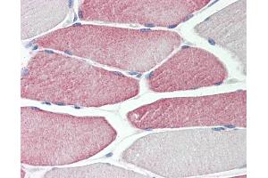 Human Skeletal Muscle: Formalin-Fixed, Paraffin-Embedded (FFPE) (CYP2D6 anticorps  (AA 268-457))
