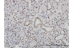 Immunoperoxidase of monoclonal antibody to PBX1 on formalin-fixed paraffin-embedded human salivary gland. (PBX1 anticorps  (AA 213-321))