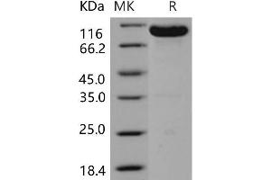 Western Blotting (WB) image for EPH Receptor B4 (EPHB4) (Active) protein (Fc Tag) (ABIN7195554) (EPH Receptor B4 Protein (EPHB4) (Fc Tag))