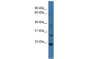 WB Suggested Anti-STARD4 Antibody Titration: 0. (STARD4 anticorps  (Middle Region))