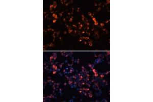 Immunofluorescence analysis of 293T cells using Mouse anti GFP-Tag mAb. (GFP anticorps  (AA 1-100))