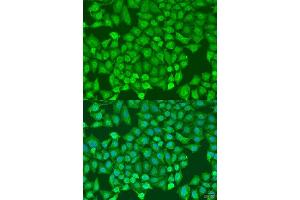 Immunofluorescence analysis of U2OS cells using CTCF antibody.