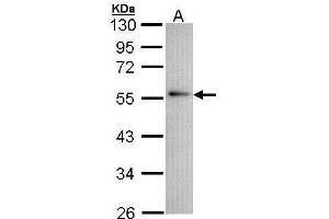 WB Image Sample (30 ug of whole cell lysate) A: A431 , 10% SDS PAGE antibody diluted at 1:1000 (Annexin A11 anticorps  (N-Term))