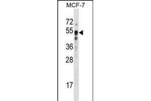 SET9 Antibody  (ABIN387997 and ABIN2845289) western blot analysis in MCF-7 cell line lysates (35 μg/lane).