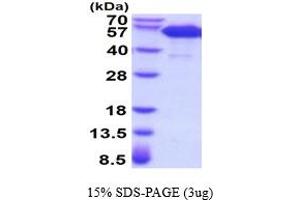 SDS-PAGE (SDS) image for Tumor Necrosis Factor Receptor Superfamily, Member 11a, NFKB Activator (TNFRSF11A) (AA 28-212) protein (hIgG-His-tag) (ABIN5854518)