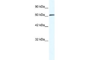 WB Suggested Anti-ZNF258 Antibody Titration:  0. (ZMYM6 anticorps  (Middle Region))