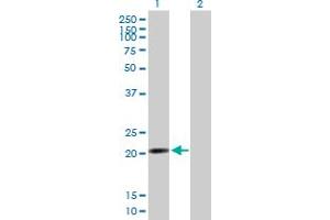 Western Blot analysis of RP13-383K5. (NUP62CL anticorps  (AA 1-184))