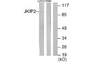 Immunohistochemistry analysis of paraffin-embedded human brain tissue using JKIP2 antibody. (JAKMIP2 anticorps)