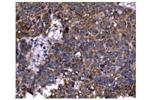 IHC analysis of PFKFB2 using anti-PFKFB2 antibody (ABIN7601627). (PFKFB2 anticorps  (AA 4-505))