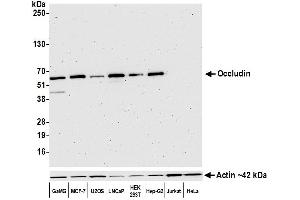 Western Blotting (WB) image for anti-Occludin (OCLN) (AA 472-522) antibody (ABIN7452581)