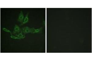 Immunofluorescence analysis of HepG2 cells, using BCL-2 (Ab-69) Antibody. (Bcl-2 anticorps  (AA 46-95))