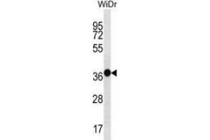 Western blot analysis in WiDr cell line lysates (35ug/lane) using Mucin-15 Antibody (C-term).