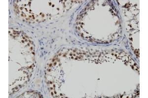 Immunoperoxidase of monoclonal antibody to PBK on formalin-fixed paraffin-embedded human testis. (PBK anticorps  (AA 1-110))