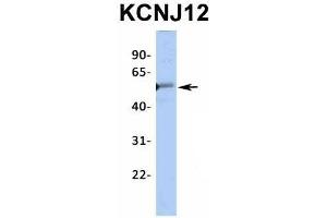 Host:  Rabbit  Target Name:  KCNJ12  Sample Type:  Human Fetal Heart  Antibody Dilution:  1. (Kir2.2 anticorps  (Middle Region))