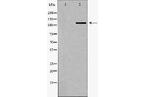 Western blot analysis of A549 whole cell lysates, using SLC4A4 Antibody. (SLC4A4 anticorps  (C-Term))