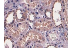 Detection of F1+2 in Human Kidney Tissue using Monoclonal Antibody to Prothrombin Fragment 1+2 (F1+2)