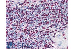 ABIN185611 (5µg/ml) staining of paraffin embedded Human Spleen. (XRCC5 anticorps  (Internal Region))