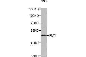 Western blot analysis of extracts of 293 cell line, using FLT1 antibody. (FLT1 anticorps  (AA 1100-1200))