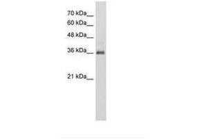 Image no. 2 for anti-Phosphatidic Acid Phosphatase Type 2A (PPAP2A) (AA 31-80) antibody (ABIN203431)