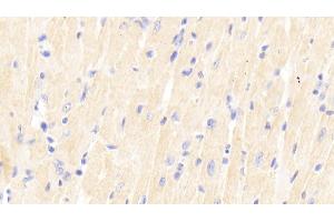 Detection of SIRT2 in Mouse Cardiac Muscle Tissue using Polyclonal Antibody to Sirtuin 2 (SIRT2) (SIRT2 anticorps  (AA 65-340))