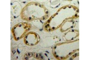 Used in DAB staining on fromalin fixed paraffin-embedded Kidney tissue