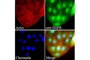 Image no. 3 for anti-Epidermal Growth Factor Receptor (EGFR) (AA 424-605) antibody (ABIN782452) (EGFR anticorps  (AA 424-605))